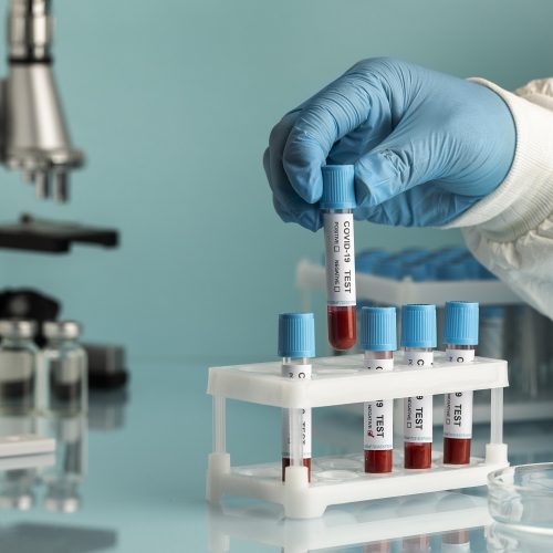 hand-with-protective-gloves-holding-blood-samples-for-covid-test